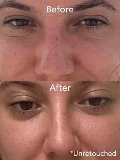 Vitamin C Booster Before & After -True Botanicals - Thumbnail Image